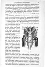 Fig. 380 - Traité de médecine opératoire, bandages et appareils. 4è éd. Tome premier