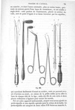 Fig. 386 - Traité de médecine opératoire, bandages et appareils. 4è éd. Tome premier