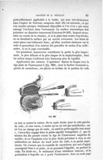 Fig. 389 - Traité de médecine opératoire, bandages et appareils. 4è éd. Tome premier