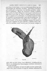 Fig. 405 - Traité de médecine opératoire, bandages et appareils. 4è éd. Tome premier