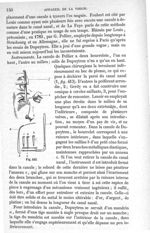 Fig. 413 - Traité de médecine opératoire, bandages et appareils. 4è éd. Tome premier