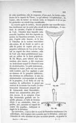 Fig. 423., Fig. 424 - Traité de médecine opératoire, bandages et appareils. 4è éd. Tome premier
