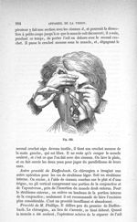 Fig. 425 - Traité de médecine opératoire, bandages et appareils. 4è éd. Tome premier