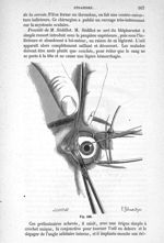 Fig. 426 - Traité de médecine opératoire, bandages et appareils. 4è éd. Tome premier