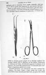 Fig. 428 bis - Traité de médecine opératoire, bandages et appareils. 4è éd. Tome premier