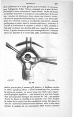 Fig. 432 - Traité de médecine opératoire, bandages et appareils. 4è éd. Tome premier