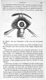Fig. 440 - Traité de médecine opératoire, bandages et appareils. 4è éd. Tome premier