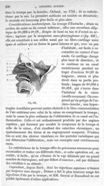 Fig. 441 - Traité de médecine opératoire, bandages et appareils. 4è éd. Tome premier