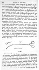 Fig. 465 / Fig. 1 Robert et Collin - Traité de médecine opératoire, bandages et appareils. 4è éd. To [...]