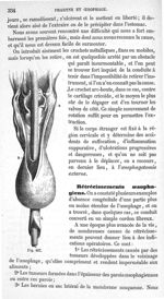 Fig. 467 - Traité de médecine opératoire, bandages et appareils. 4è éd. Tome premier