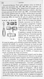 Fig. 487 à Fig. 493 - Traité de médecine opératoire, bandages et appareils. 4è éd. Tome premier
