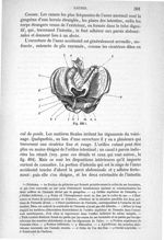 Fig. 494 - Traité de médecine opératoire, bandages et appareils. 4è éd. Tome premier