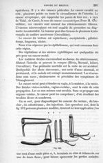 Fig. 512 - Traité de médecine opératoire, bandages et appareils. 4è éd. Tome premier