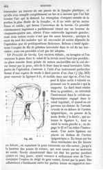 Fig. 515 - Traité de médecine opératoire, bandages et appareils. 4è éd. Tome premier