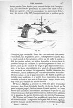 Fig. 517 - Traité de médecine opératoire, bandages et appareils. 4è éd. Tome premier