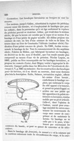 Fig. 534., Fig. 535 - Traité de médecine opératoire, bandages et appareils. 4è éd. Tome premier