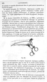 Fig. 543 - Traité de médecine opératoire, bandages et appareils. 4è éd. Tome premier