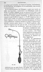 Fig. 547 - Traité de médecine opératoire, bandages et appareils. 4è éd. Tome premier
