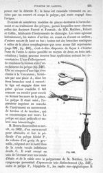 Fig. 548 - Traité de médecine opératoire, bandages et appareils. 4è éd. Tome premier