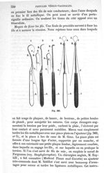 Fig. 560 - Traité de médecine opératoire, bandages et appareils. 4è éd. Tome premier