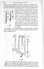 Fig. 561., Fig. 562 - Traité de médecine opératoire, bandages et appareils. 4è éd. Tome premier