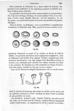 Fig. 564., Fig. 565 - Traité de médecine opératoire, bandages et appareils. 4è éd. Tome premier