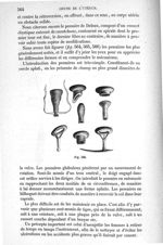 Fig. 566 - Traité de médecine opératoire, bandages et appareils. 4è éd. Tome premier