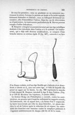 Fig. 567., Fig. 568 - Traité de médecine opératoire, bandages et appareils. 4è éd. Tome premier