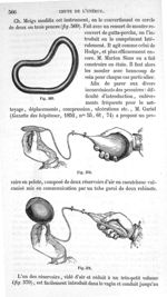 Fig. 569 à Fig. 571 - Traité de médecine opératoire, bandages et appareils. 4è éd. Tome premier