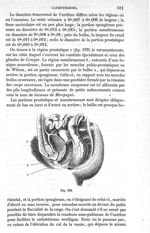 Fig. 579 - Traité de médecine opératoire, bandages et appareils. 4è éd. Tome premier