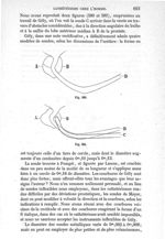 Fig. 580., Fig. 581 - Traité de médecine opératoire, bandages et appareils. 4è éd. Tome premier