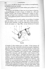 Fig. 582 - Traité de médecine opératoire, bandages et appareils. 4è éd. Tome premier