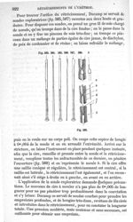 Fig. 589 - Traité de médecine opératoire, bandages et appareils. 4è éd. Tome premier
