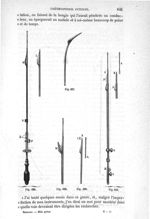Fig. 636 à Fig. 640 - Traité de médecine opératoire, bandages et appareils. 4è éd. Tome premier