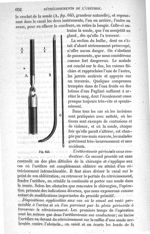 Fig. 643 - Traité de médecine opératoire, bandages et appareils. 4è éd. Tome premier