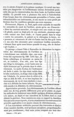 Fig. 644 à Fig. 649 - Traité de médecine opératoire, bandages et appareils. 4è éd. Tome premier