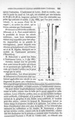 Fig. 650 à Fig. 652 - Traité de médecine opératoire, bandages et appareils. 4è éd. Tome premier