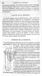 Fig. 653 - Traité de médecine opératoire, bandages et appareils. 4è éd. Tome premier