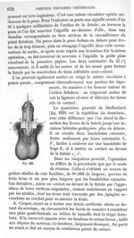 Fig. 659 - Traité de médecine opératoire, bandages et appareils. 4è éd. Tome premier