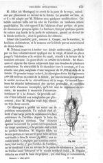 Fig. 660 - Traité de médecine opératoire, bandages et appareils. 4è éd. Tome premier