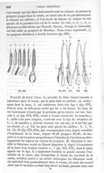 Fig. 670 à Fig. 674 - Traité de médecine opératoire, bandages et appareils. 4è éd. Tome premier