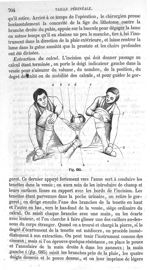 Fig. 685 - Traité de médecine opératoire, bandages et appareils. 4è éd. Tome premier