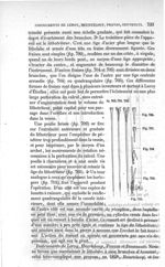 Fig. 703 à Fig. 710 - Traité de médecine opératoire, bandages et appareils. 4è éd. Tome premier