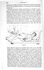 Fig. 711 - Traité de médecine opératoire, bandages et appareils. 4è éd. Tome premier