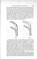 Fig. 719., Fig. 720 - Traité de médecine opératoire, bandages et appareils. 4è éd. Tome premier