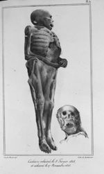 Cadavre inhumé le 8 février 1828 et exhumé le 27 novembre 1828 - Traité de médecine légale, suivi du [...]