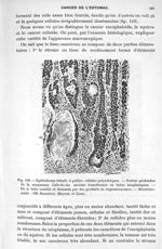 Fig. 108. Epithélioma tubulé, à petites cellules polyédriques. Parties profondes de la muqueuse. Cul [...]