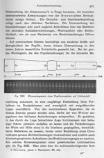 Fig. XXI. Kinematogramm einer Pupillenreaktion auf Lichteinfall - Psychiatrie : ein Lehrbuch für Stu [...]