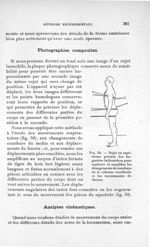 Fig. 59. Sujet en expérience portant des baguettes indicatrices pour explorer et amplifier les chang [...]