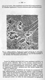 Fig. 8 - Région lombaire - La poliomyélite épidémique (maladie de Heine-Médin). Travail du service d [...]